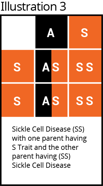 Punnet square, 3x3 grid, Sickle Cell Disease (SS); Parent S Trait & SS; pattern: A, S, S, AS, SS, S, AS, SS.